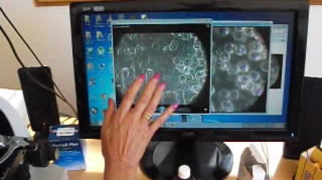 My Own Test of Live Blood Analysis, part 4