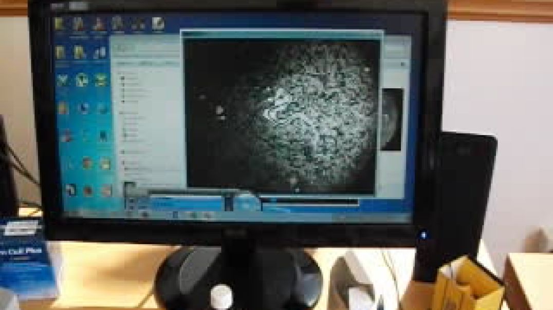 My Own Test of Live Blood Analysis, part 2