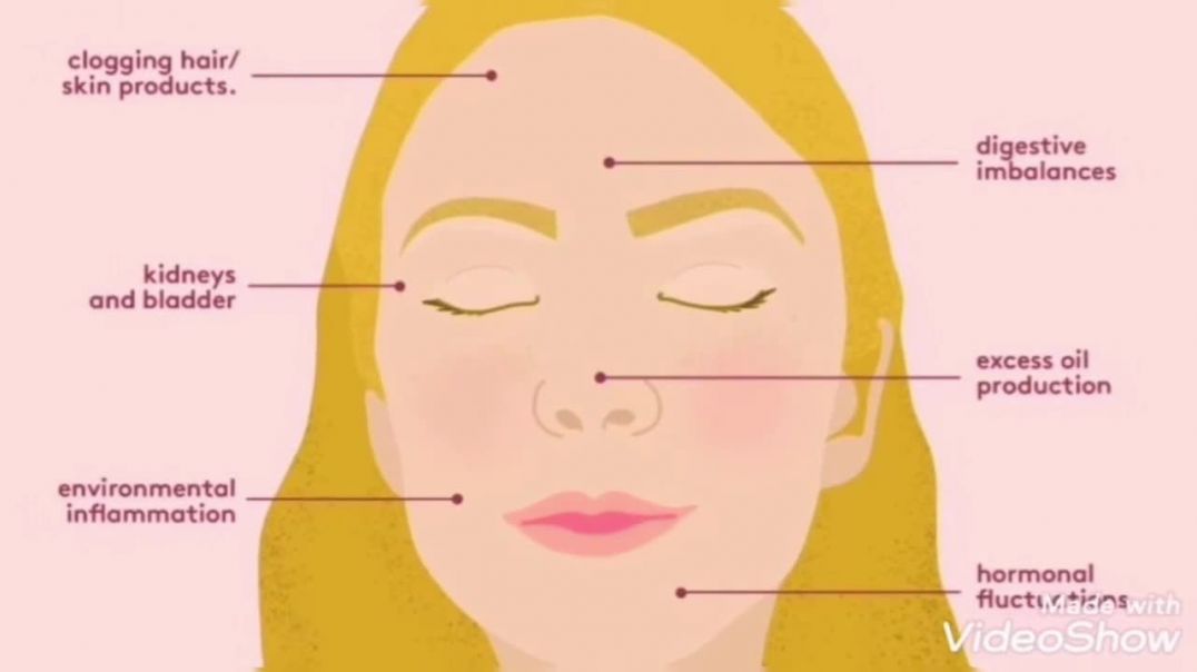 Natural Remedies for Pimples and Acne Disease | for all Skin Problems