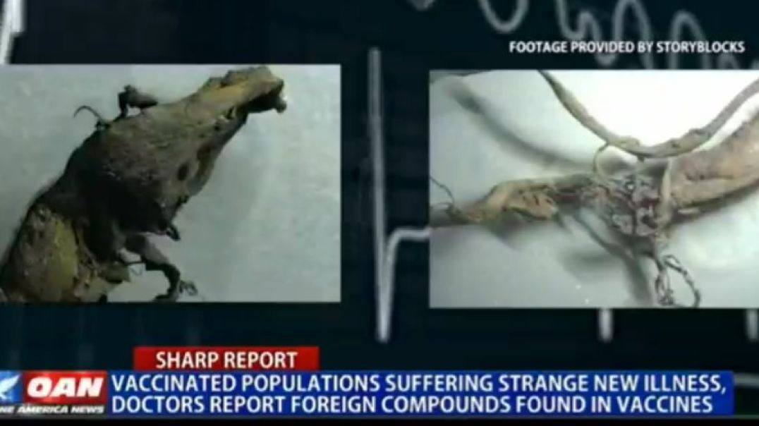 Scary videos and Images of COVID Vaccine Injuries