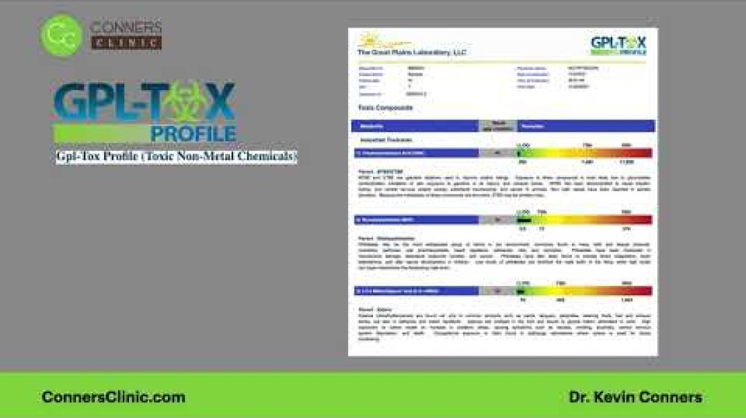Toxin Testing lab Bundle | Conners Clinic - Alternative Coaching