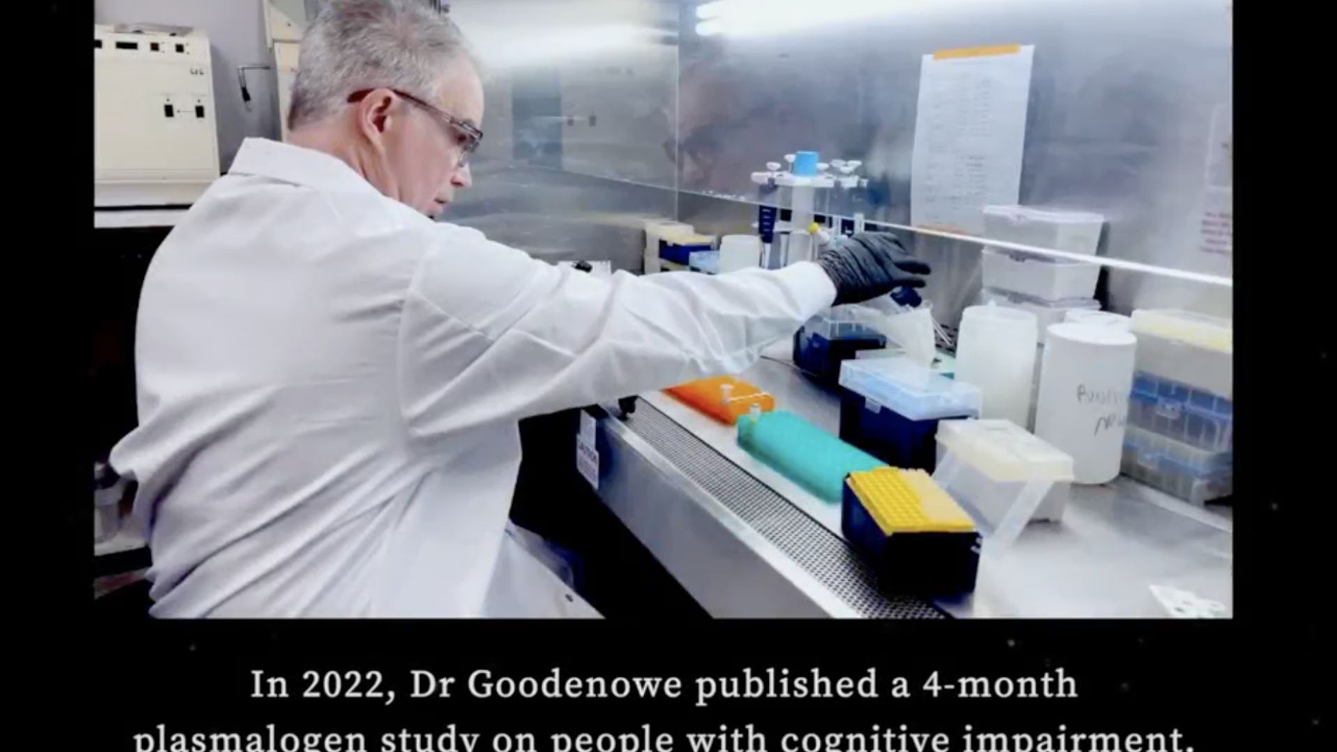 Key to Curing Alzheimer’s and Rare Childhood Disease–RCDP–Lie in Plasmalogens?
